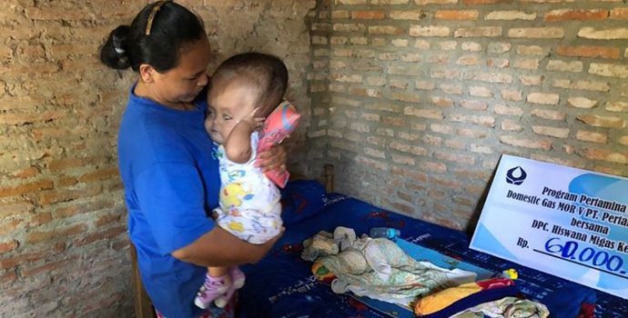 Pertamina Domgas V & Hiswana Migas Santuni Bayi Penderita Hidrosefalus Senilai Rp 60 Juta
